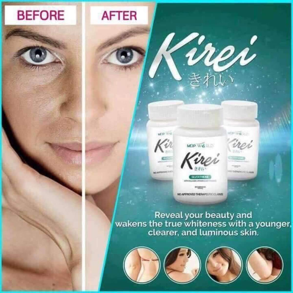 Authentic Kirei Glutathione 30 capsules